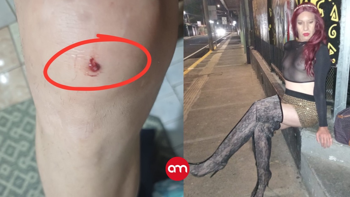 Leonela frecuenta el sector del asilo en Cartago. En la foto una de sus lesiones.
