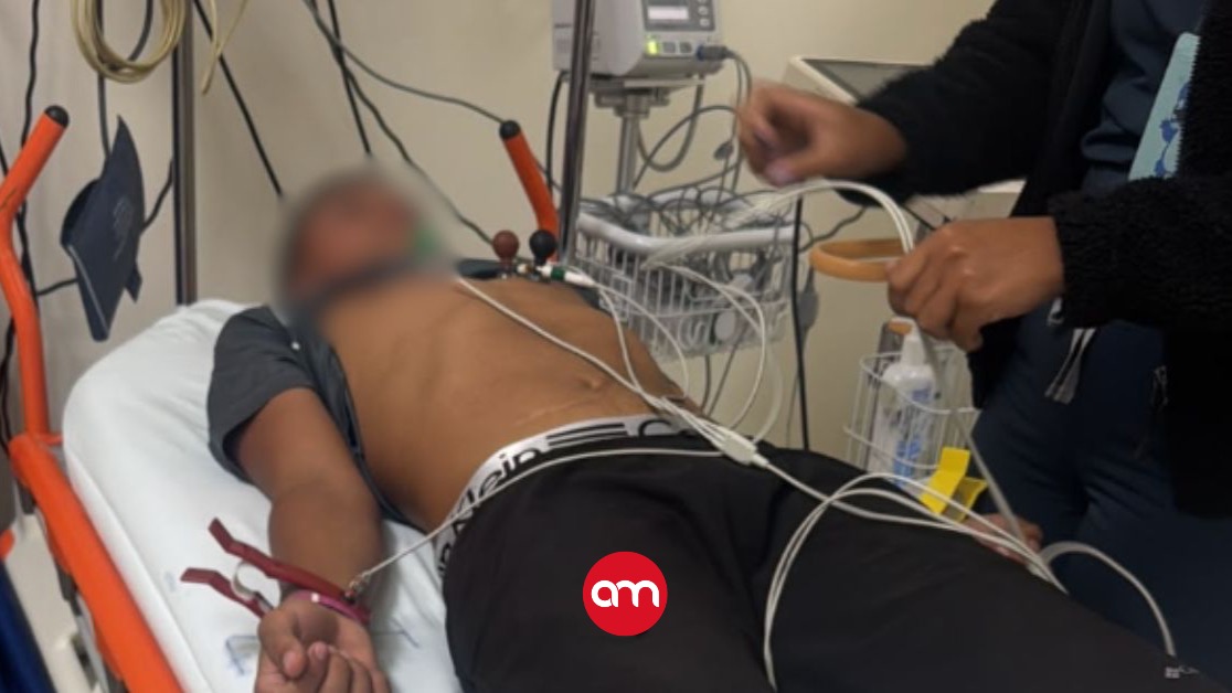Tres días antes de trágica muerte de una niña, adolescente también sufrió una descarga eléctrica en el mismo balneario