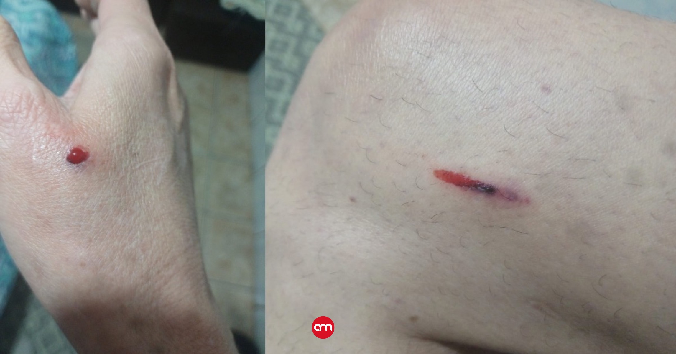 Imagen de las lesiones en una mano y pierna de Leonela.